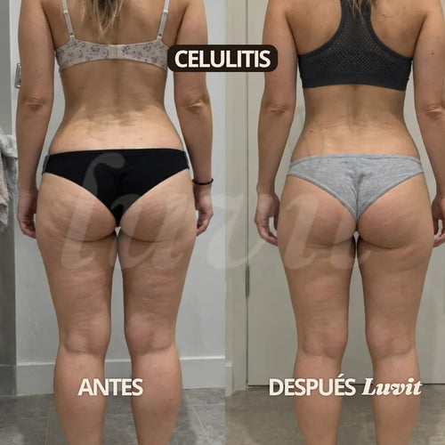 Crema Botánica 4 en 1 · Celulitis, Estrías y Resequedad · 100% natural
